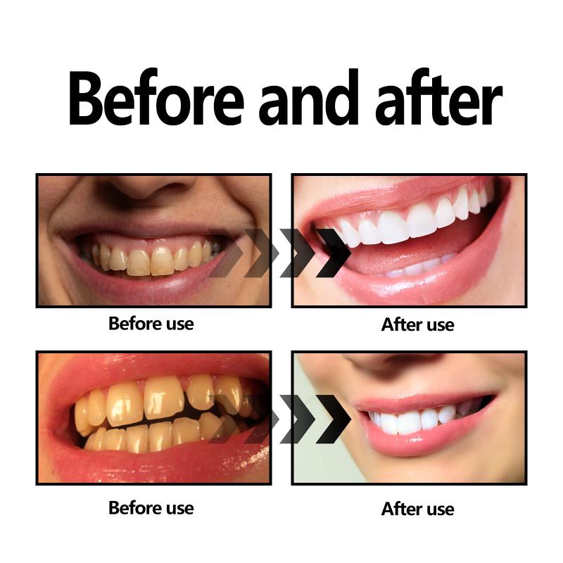Teeth Whitening Powder Charcoa - Teeth Whitening With Baking Soda avaliação e preço