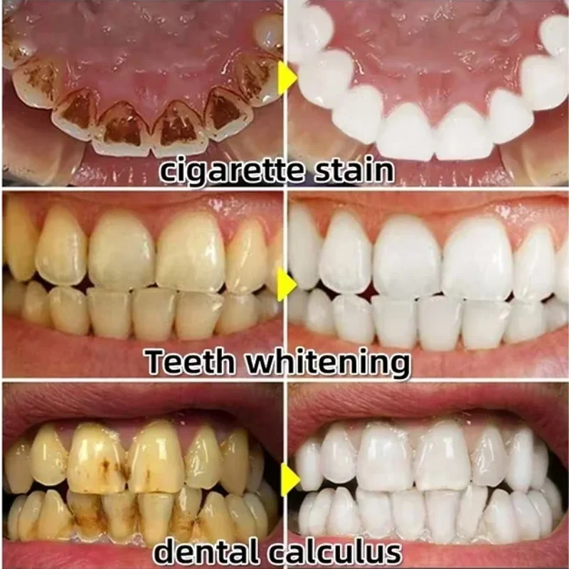 Quickly Repair Gum Serum Relie - Teeth Whitening With Baking Soda avaliação e preço
