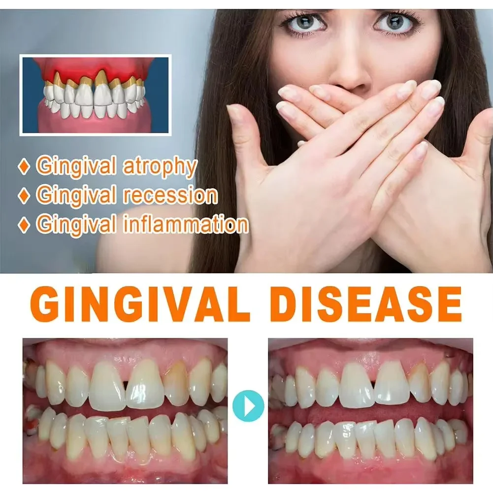 Quickly Repair Gum Serum Relie - Teeth Whitening With Baking Soda avaliação e preço