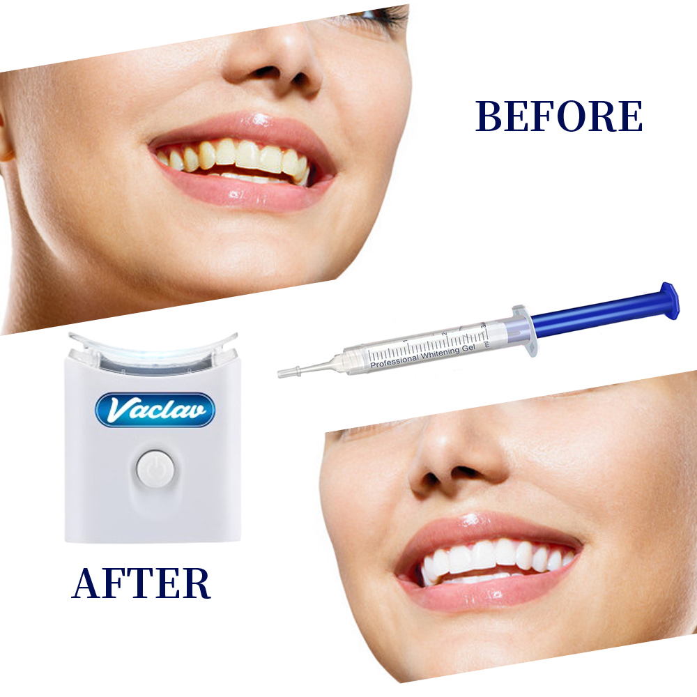 Mint Teeth Whitening Gel Syrin - Teeth Whitening Gel Syringes avaliação e preço