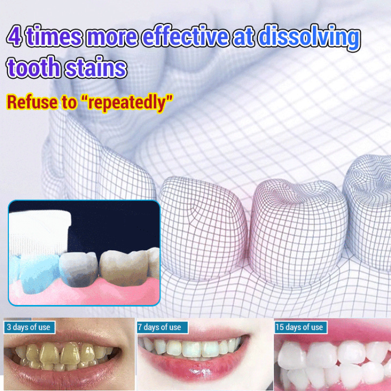 Baking Soda Whiten Teeth Fresh - Teeth Whitening With Baking Soda avaliação e preço