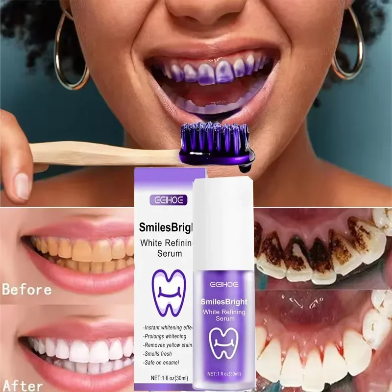 Teeth Cleansing Whitening Toot - Teeth Whitening Korea avaliação e preço