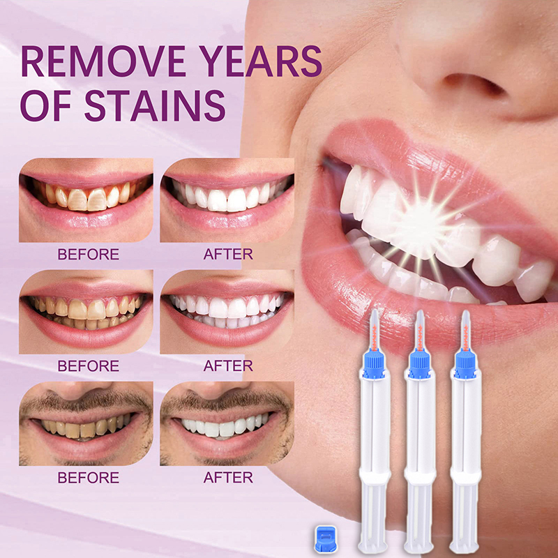Dental Clinic Dual Barrier Syr - Teeth Whitening Gel Syringes avaliação e preço