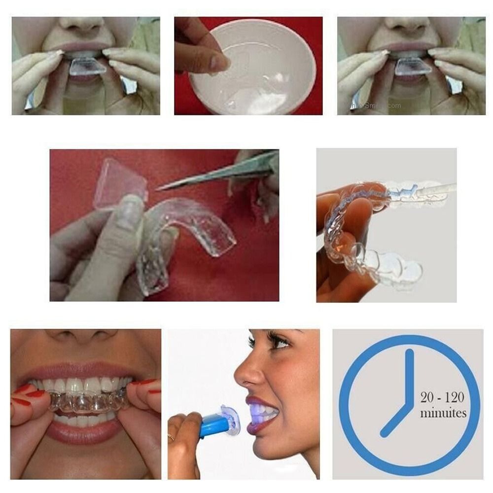 Silicone Night Mouth Guard Too - Dental Guard Night avaliação e preço