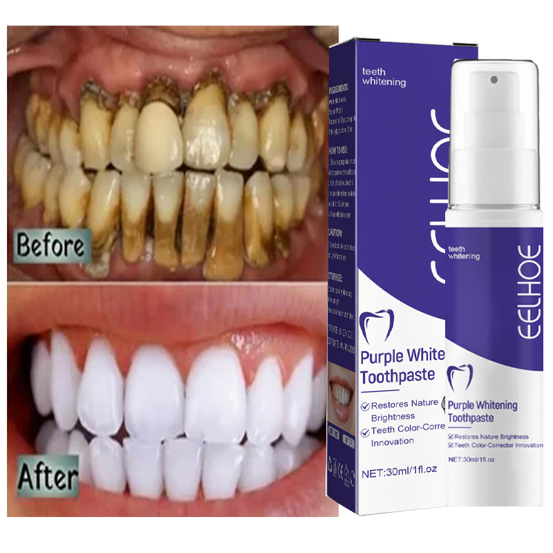 1pcs Teeth Cleansing Whitening - Teeth Whitening Korea avaliação e preço