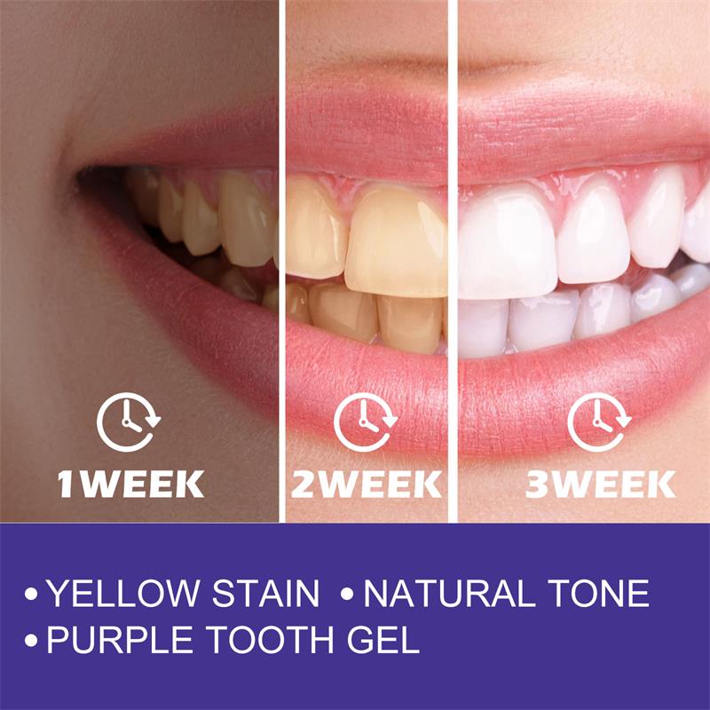 1pcs Teeth Cleansing Whitening - Teeth Whitening Korea avaliação e preço