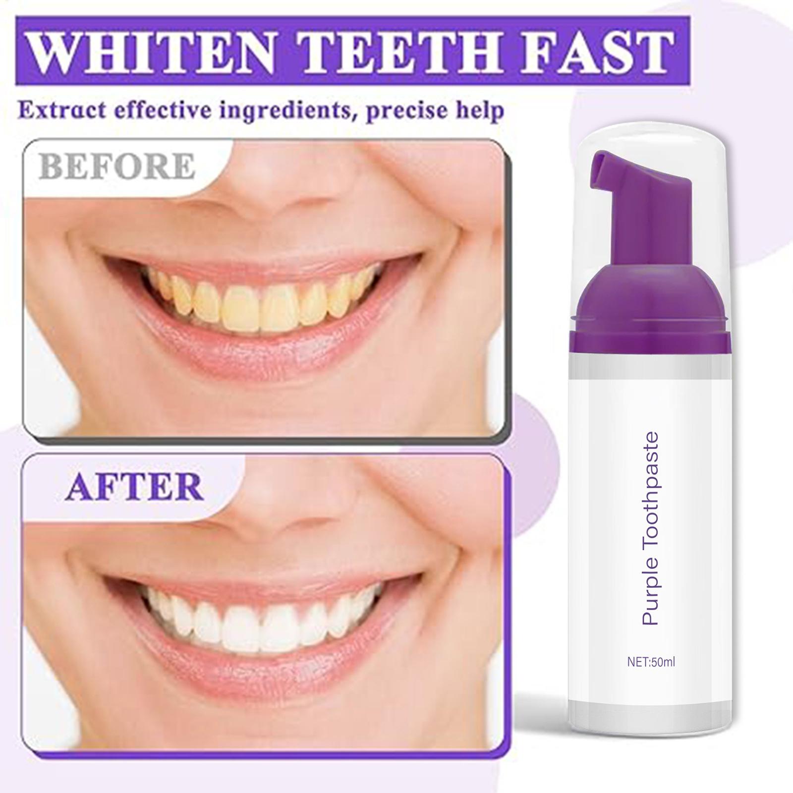 50ml Foam Toothpaste Brighteni - Teeth Whitening Before And After avaliação e preço