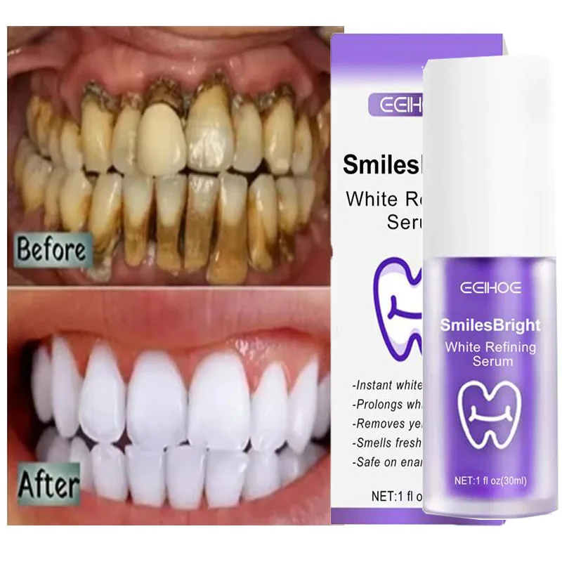 Whitening Toothpaste Teeth Cle - Teeth Whitening Korea avaliação e preço