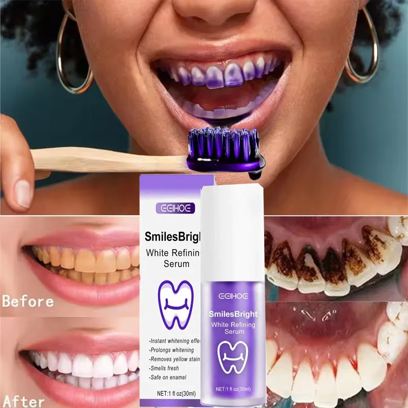 Whitening Toothpaste Teeth Cle - Teeth Whitening Korea avaliação e preço