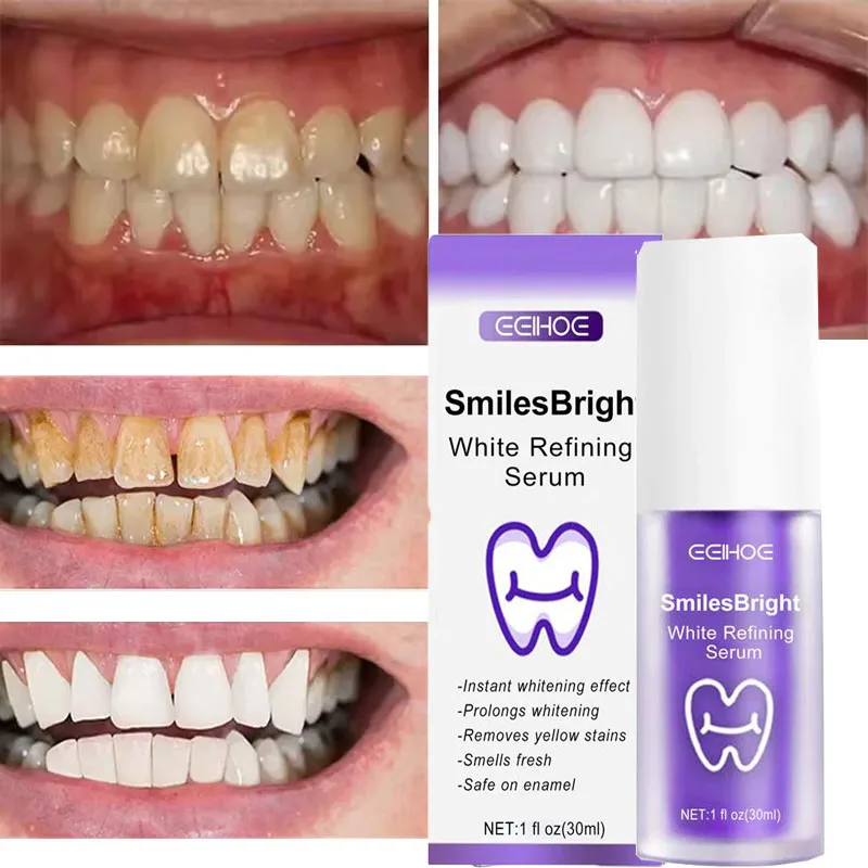 Whitening Toothpaste Teeth Cle - Teeth Whitening Korea avaliação e preço
